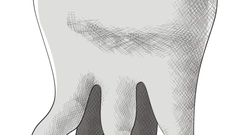 ​